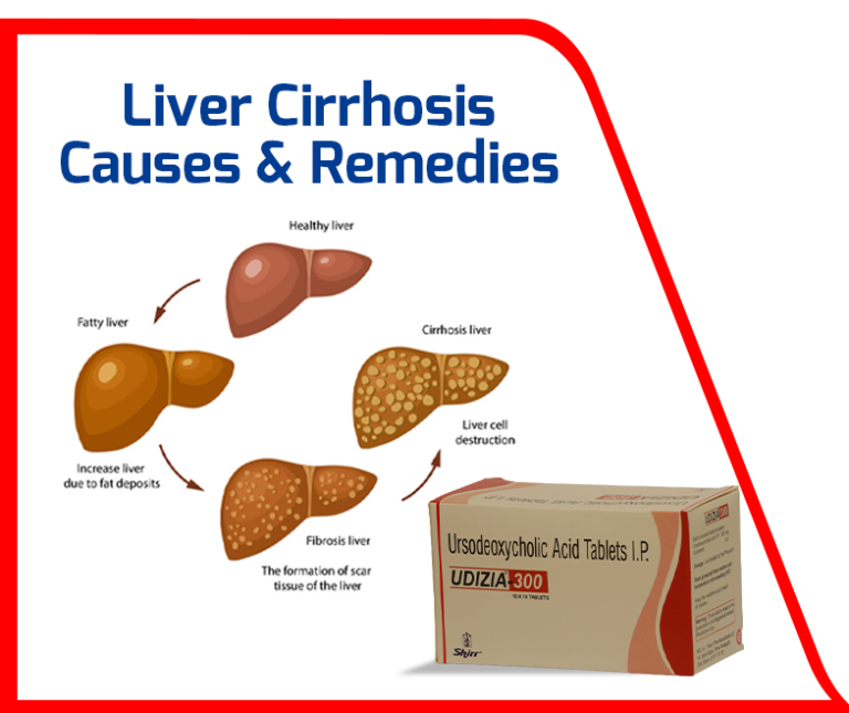 Liver Cirrhosis Causes & Treatments Medicine Manufacturing SHIRR